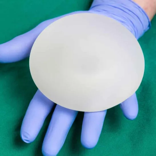 Breast implant - Alamy Stock Photo