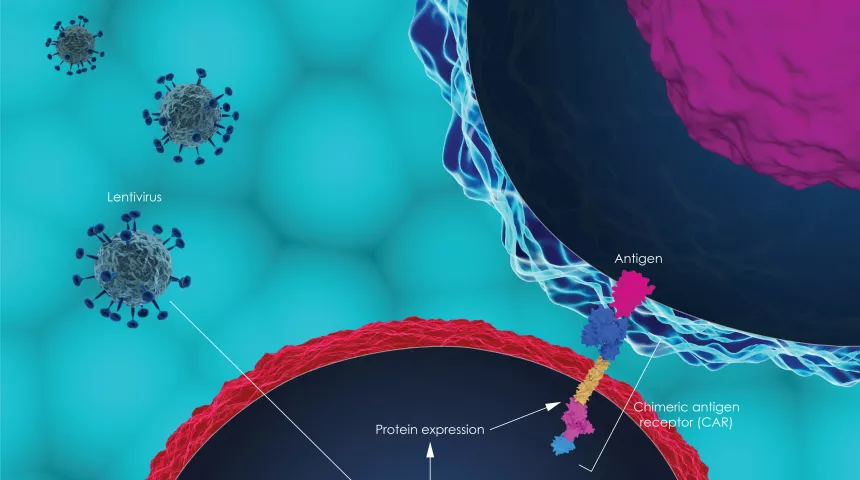 CAR T-cell therapy image