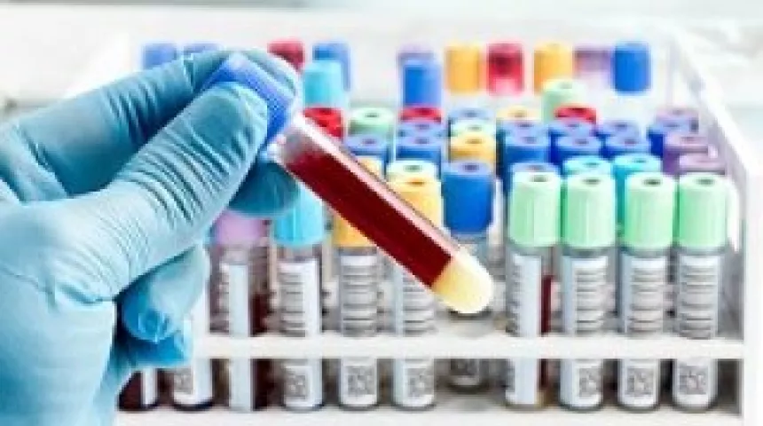 Hand holding a blood sample in a vial